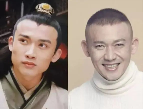 华晨宇整容_娱乐圈没整过容的明星_刘恺威整容后遗症