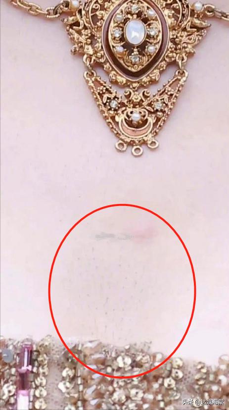 女明星体毛话题_迪丽热巴毛发旺盛_女明星的毛