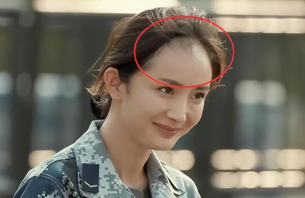 杨幂赵丽颖金晨假发片_发量少的女明星有哪些_女明星脱发严重